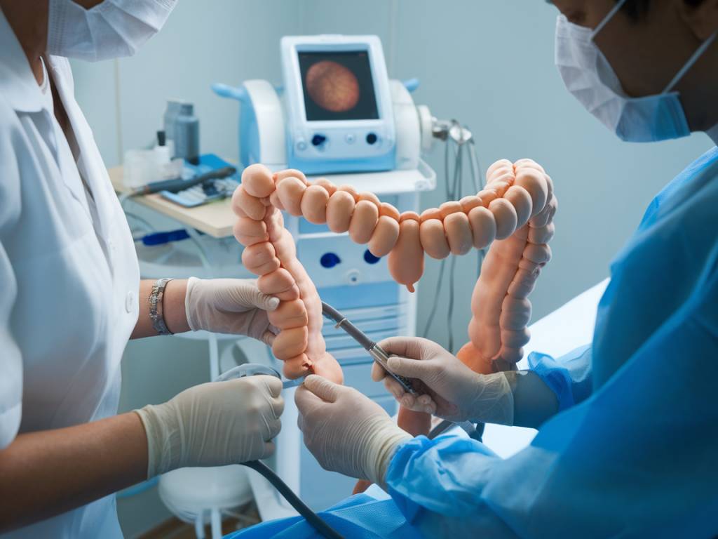 Prévention du cancer colorectal